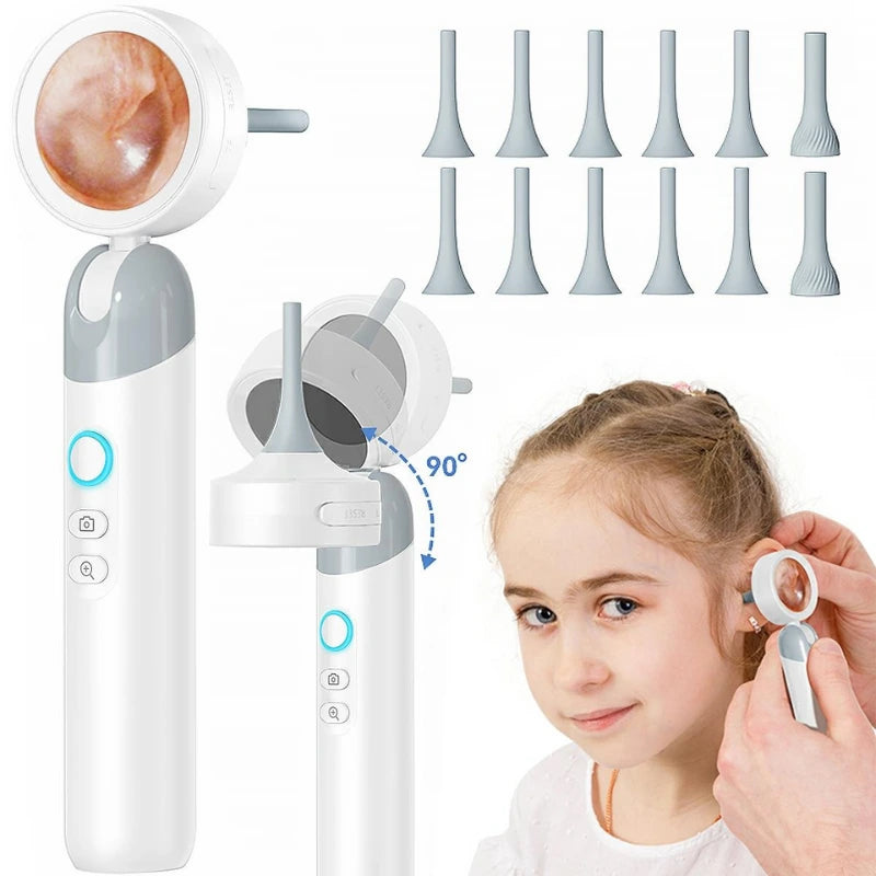 Visual Smart Otoscope