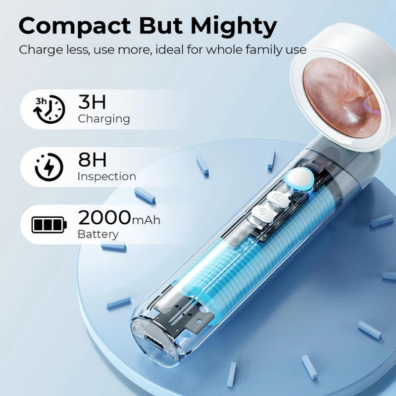 Visual Smart Otoscope