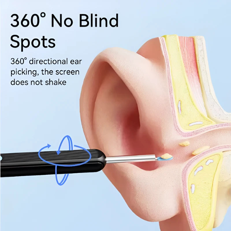 Wireless Earwax Remover