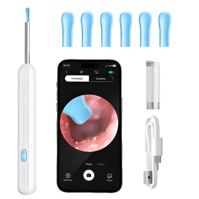 Wireless Earwax Remover