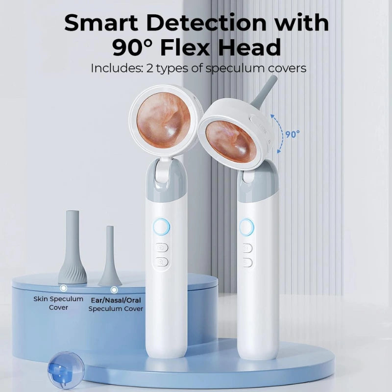 Visual Smart Otoscope