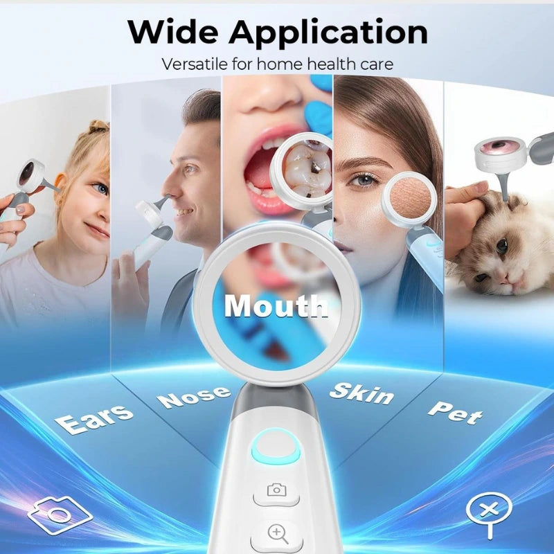 Visual Smart Otoscope